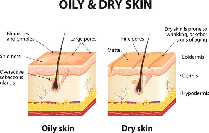 What Makes Skin Oily
