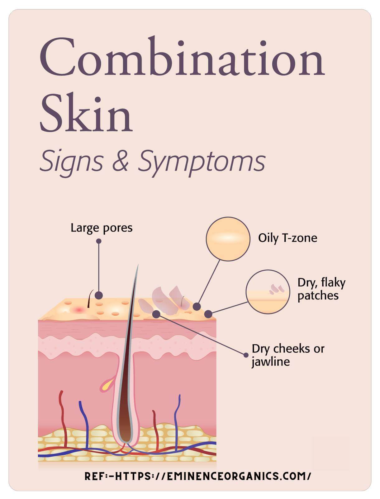 What does combination skin look like