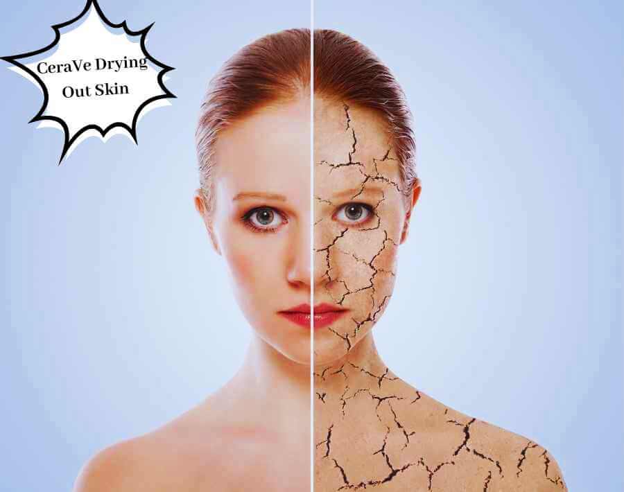 CeraVe Drying Out Skin: Understanding Causes & Solutions