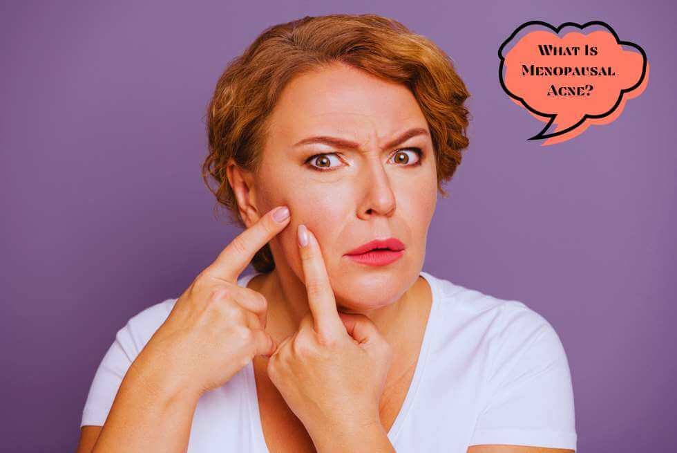 What is Menopausal Acne